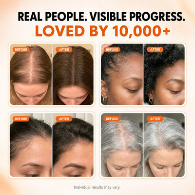 TSR® Korean Scalp Serum
