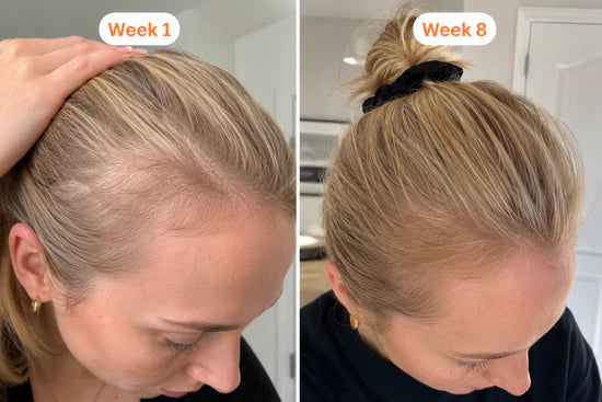 Before and after