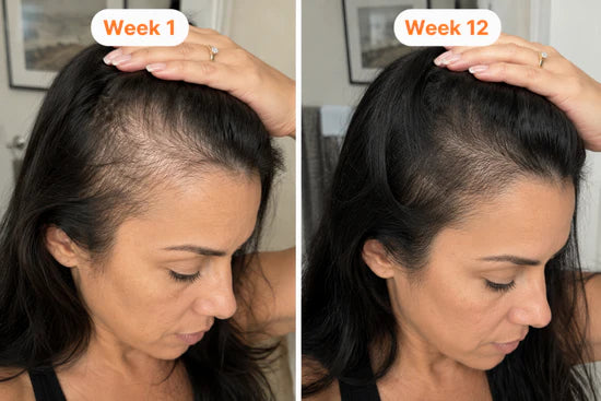 Before and after