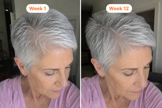 Before and after