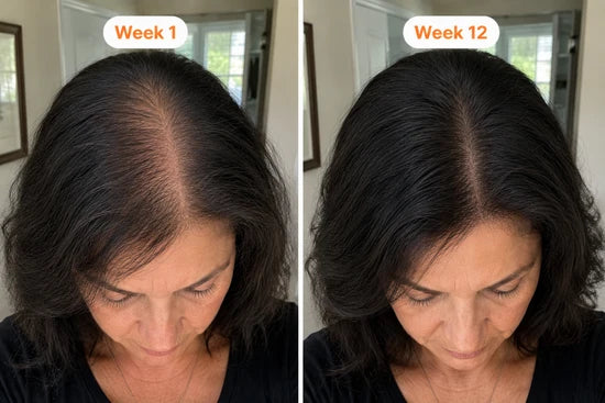 Before and after