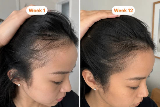 Before and after