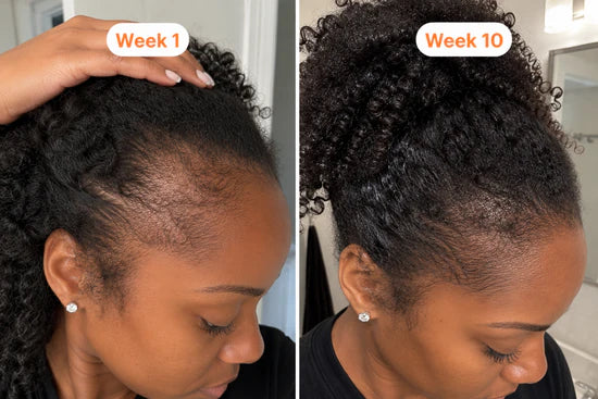 Before and after